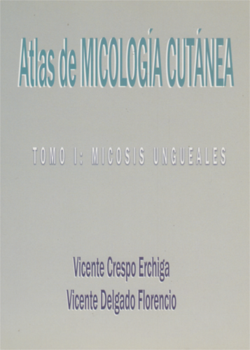 micosis-ungueales-tomoi
